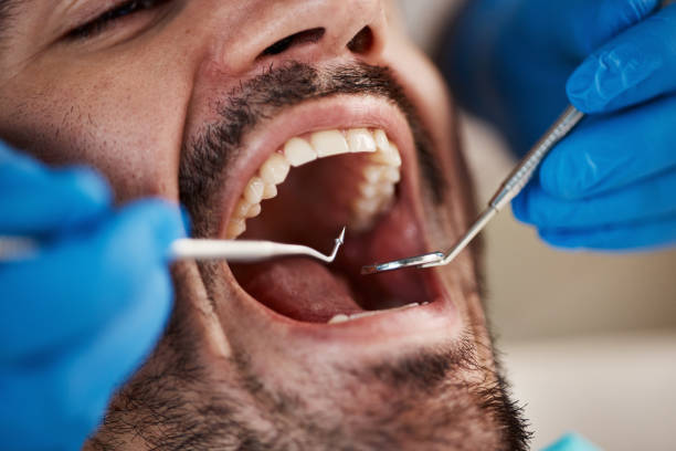 Best Broken or Cracked Tooth Emergency Dentist in Rice Lake, WI